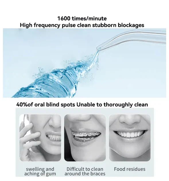Oral Irrigator – Find Your Beauty